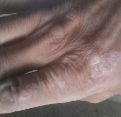 ����ţƤѢ����ʳ������Щע���?